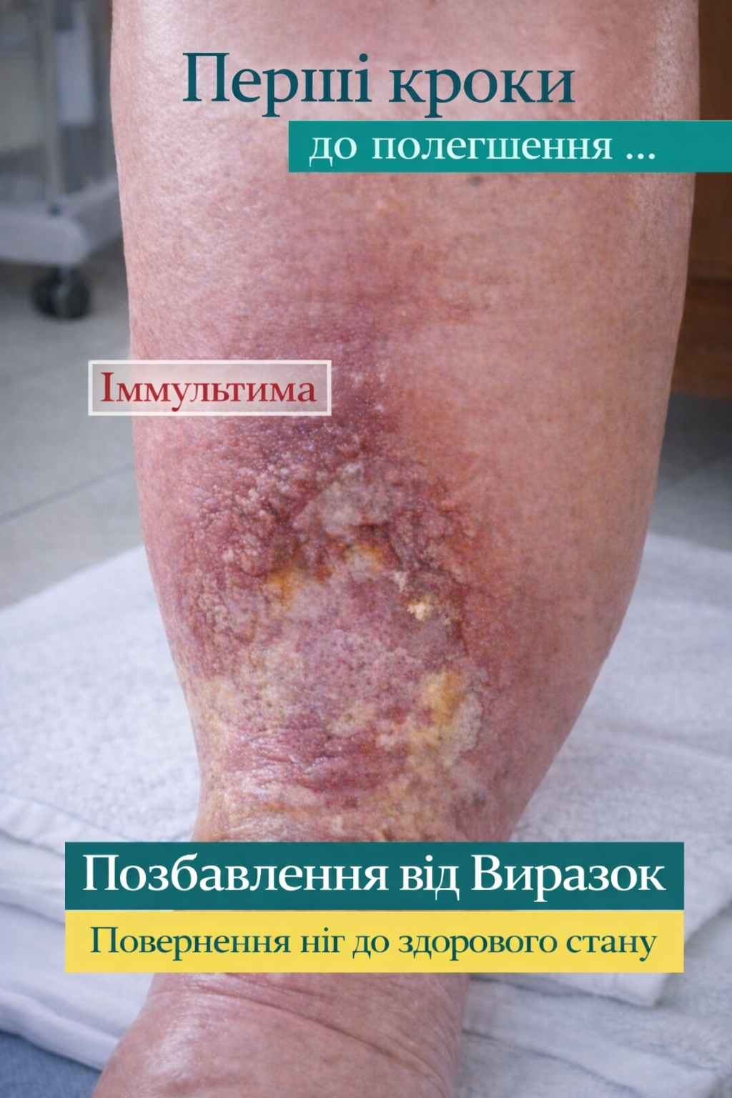 Рани та набряки ніг